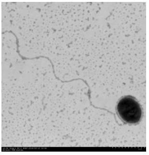 N-acyl high serine lactone quenching bacterium and application thereof in disease control