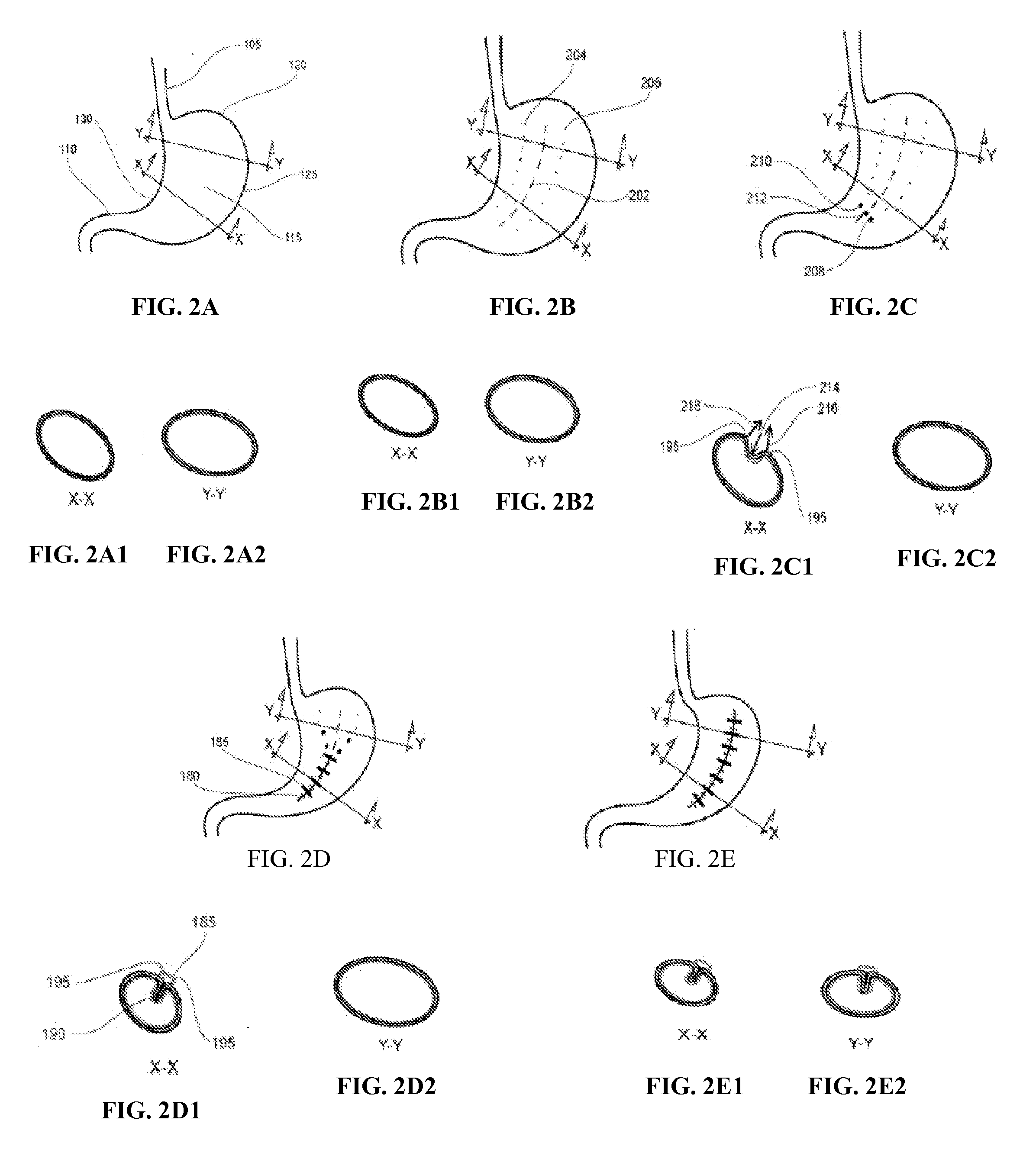 Devices and systems for manipulating tissue