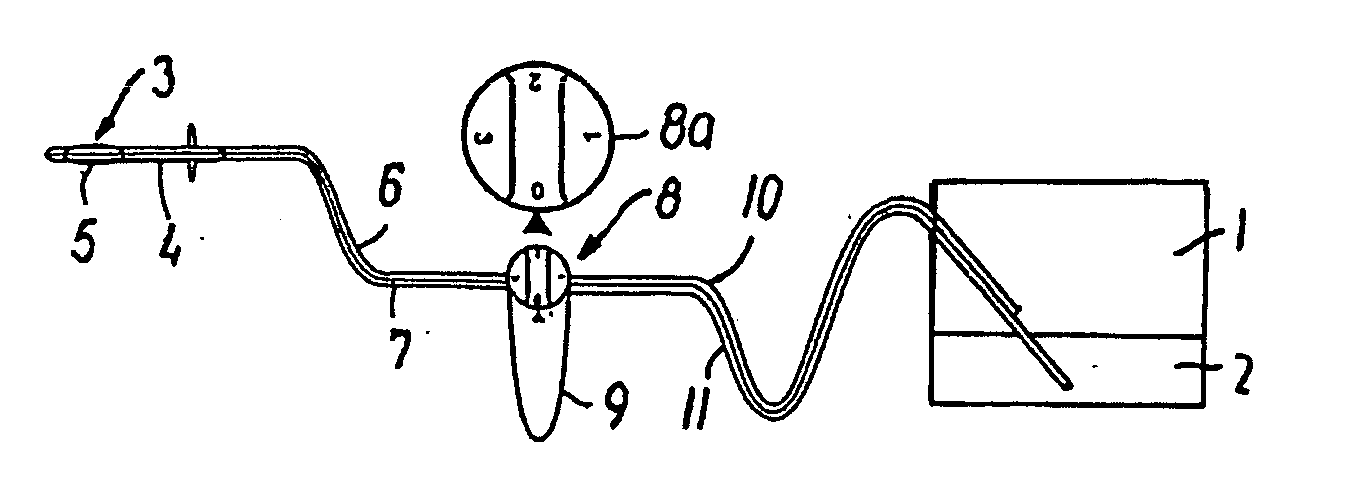 Irrigation system