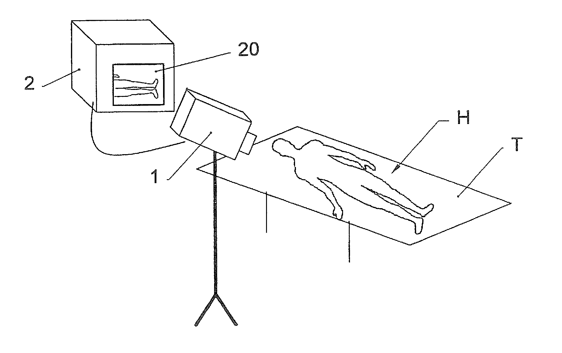 Method and control system for a treatment by subcutaneous or intracutaneous irradiation by means of electromagnetic radiation