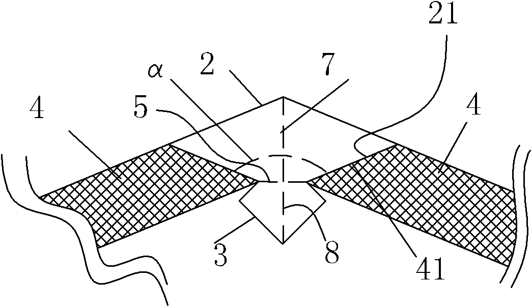 Corner lock for decorative engineering