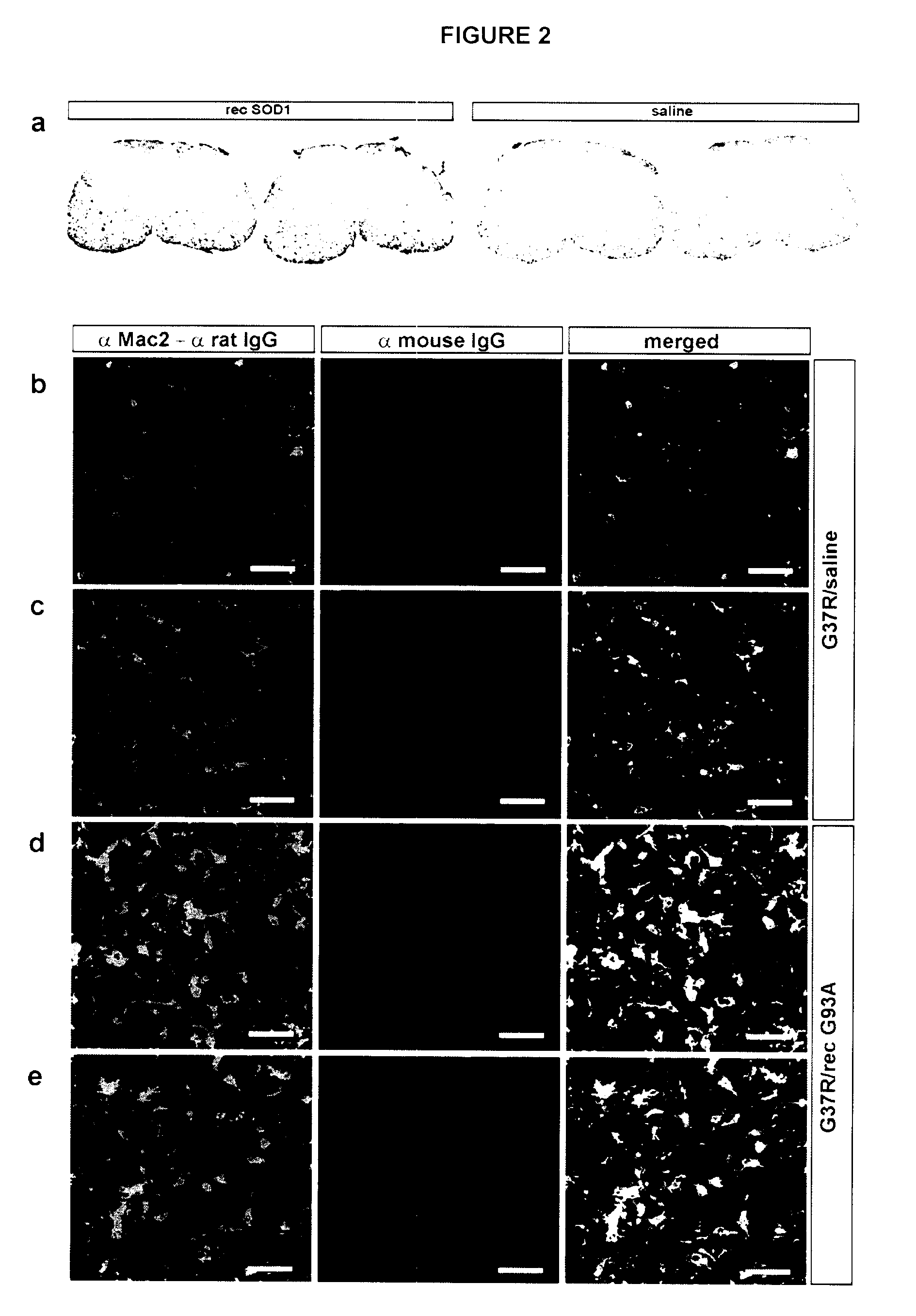 Antibodies and Their Use In The Treatment, Prevention and Diagnosis of a Disease Associated With SOD1 Abnormalities