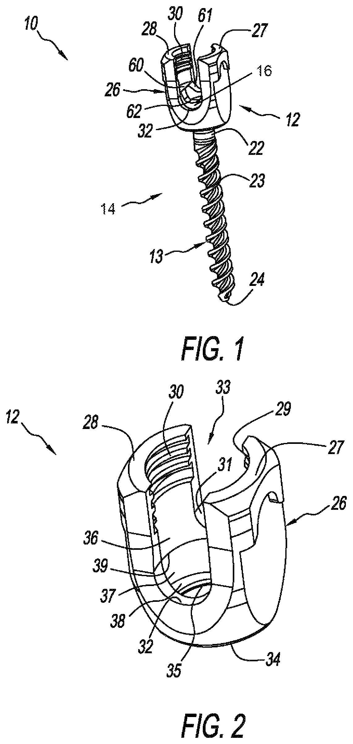 Modular pedicle screw with multi-part cam lock structure