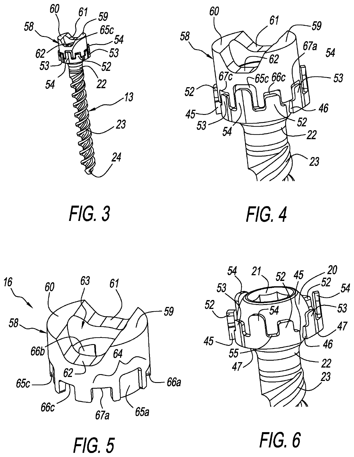 Modular pedicle screw with multi-part cam lock structure