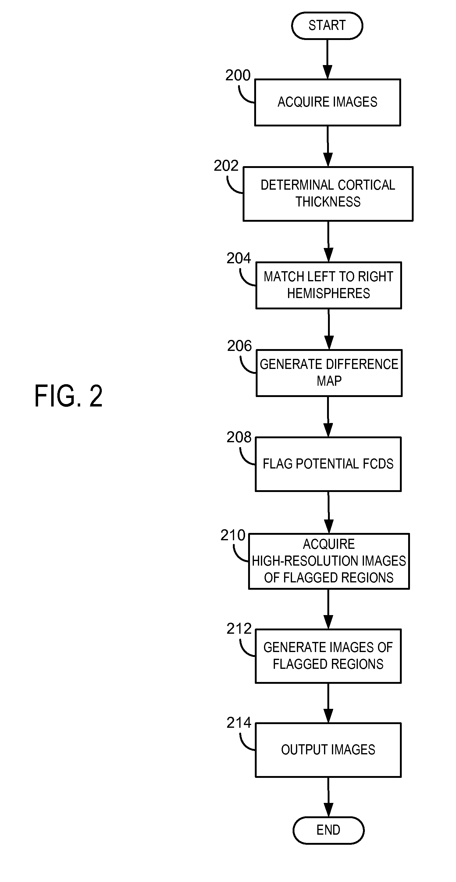 System and method for diagnosis of focal cortical dysplasia