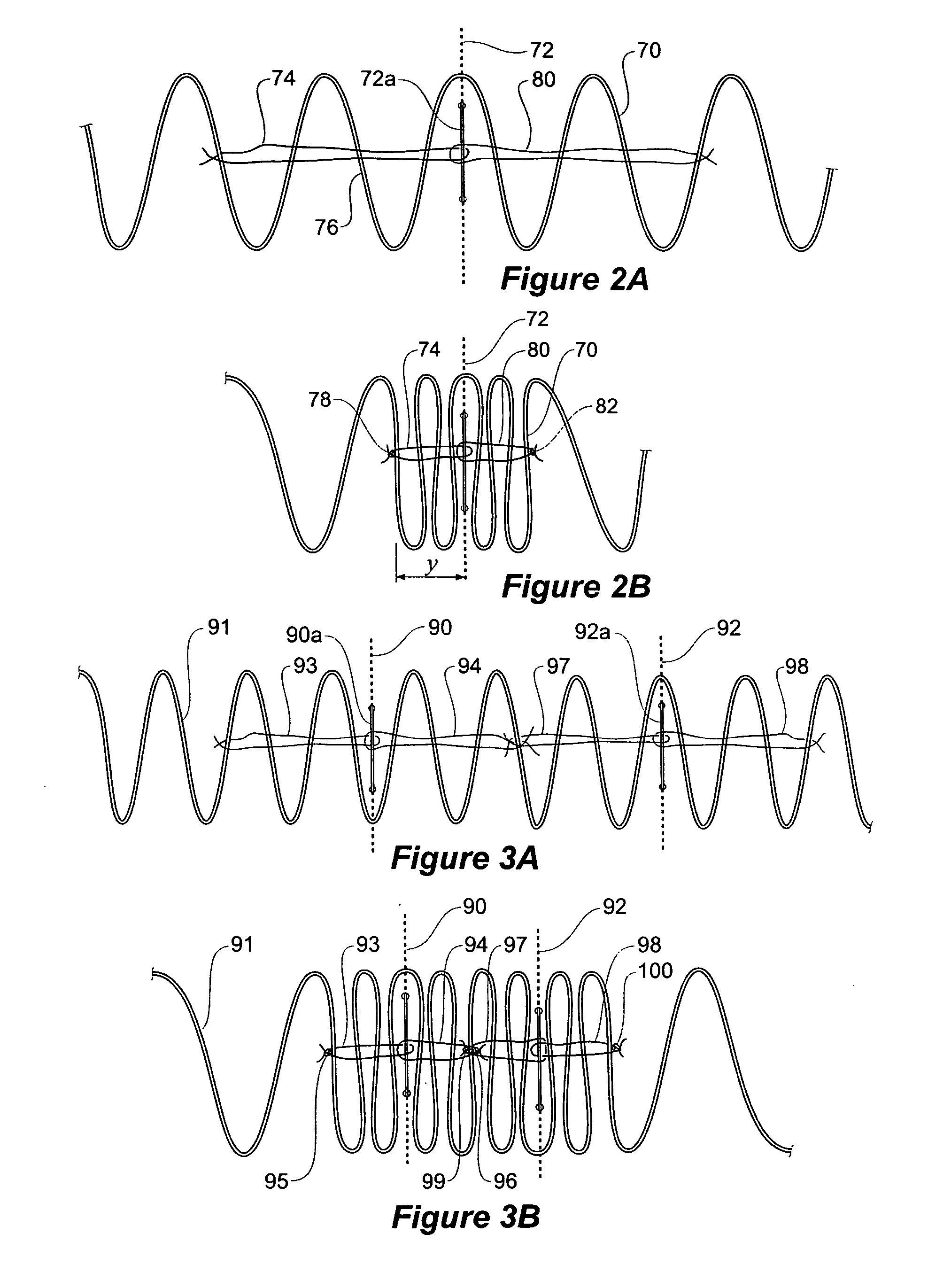 Assembly of stent grafts