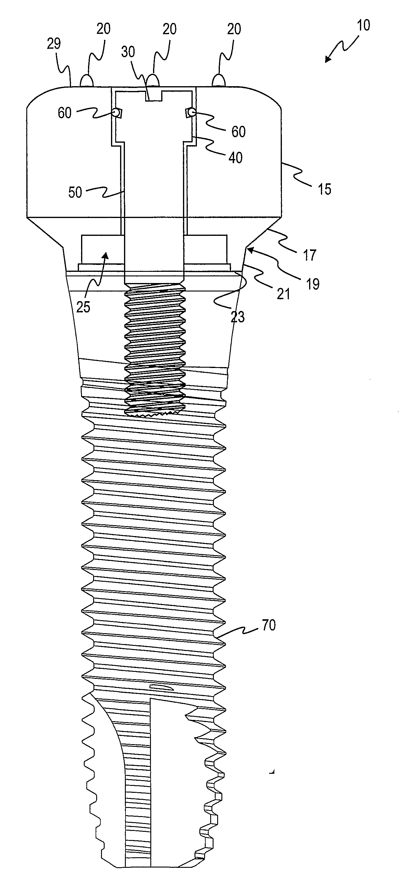 Method For Manufacting Dental Implant Components