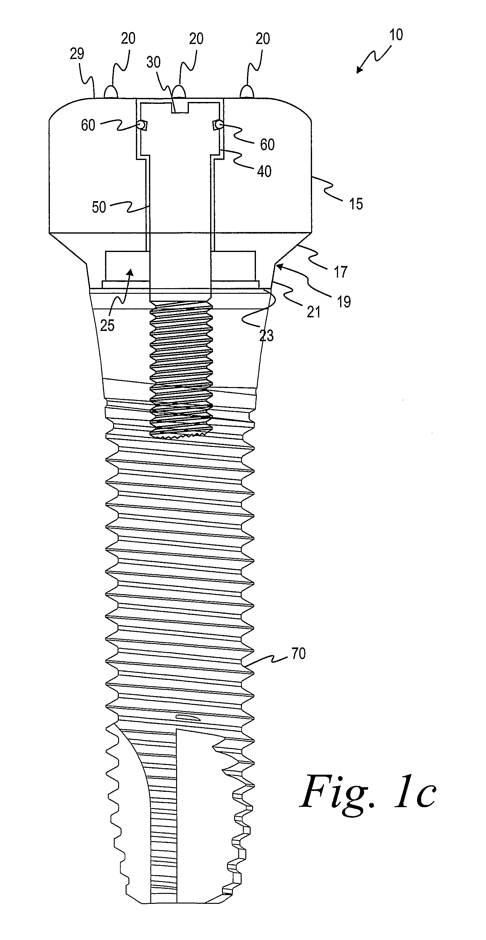 Method For Manufacting Dental Implant Components