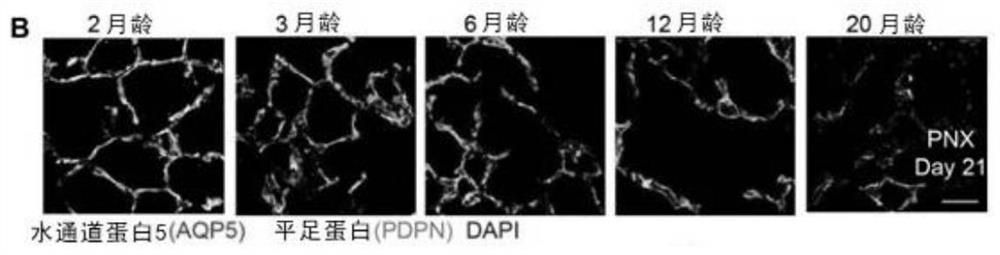 Application of EPCR pathway activator in preparation of anti-fibrosis agent