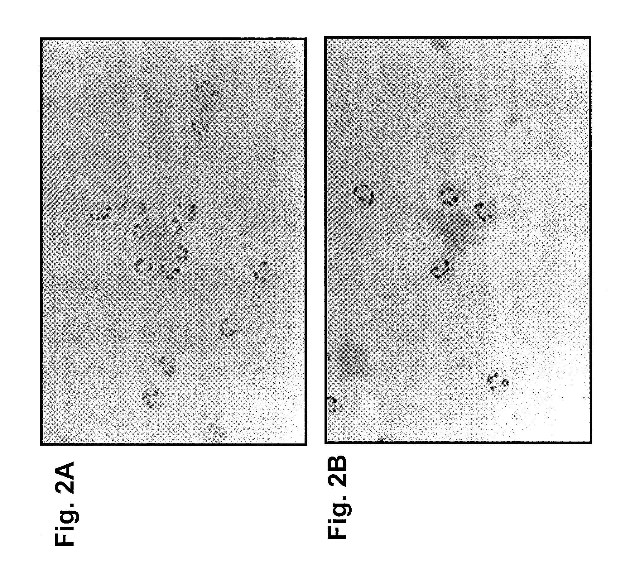 Methods for amyloid removal using anti-amyloid antibodies