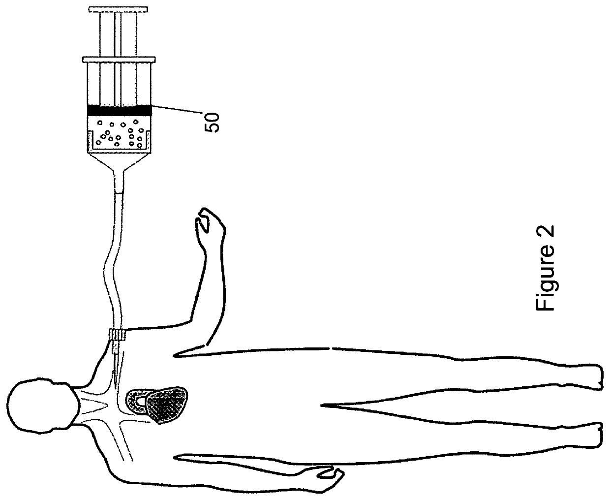 Isolating and purifying cells for therapy