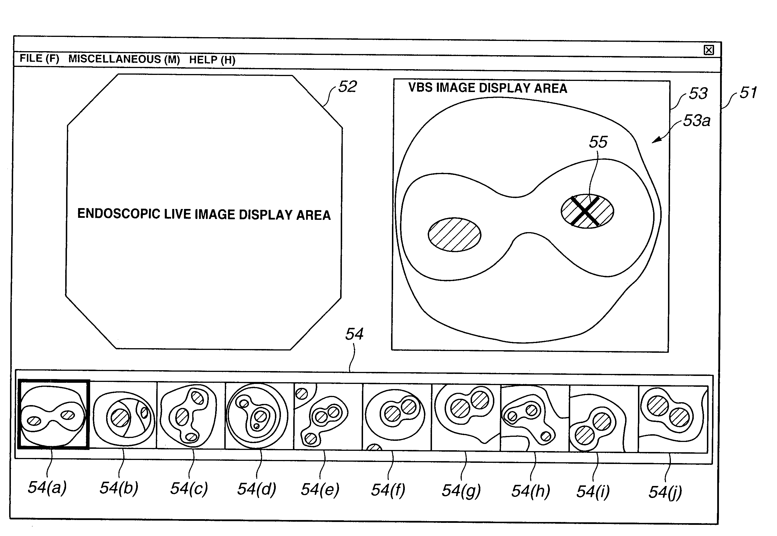 Endoscope device and navigation method for endoscope device