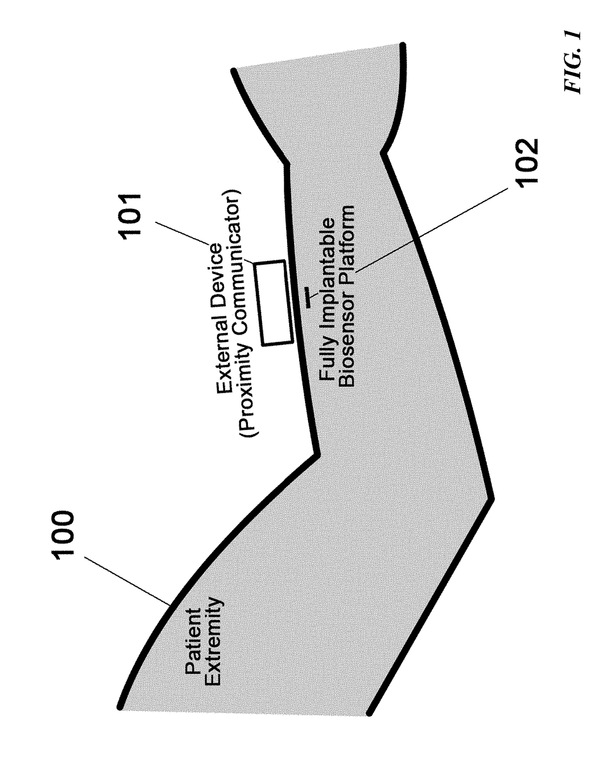 Spatial Detection and Alignment of an Implantable Biosensing Platform