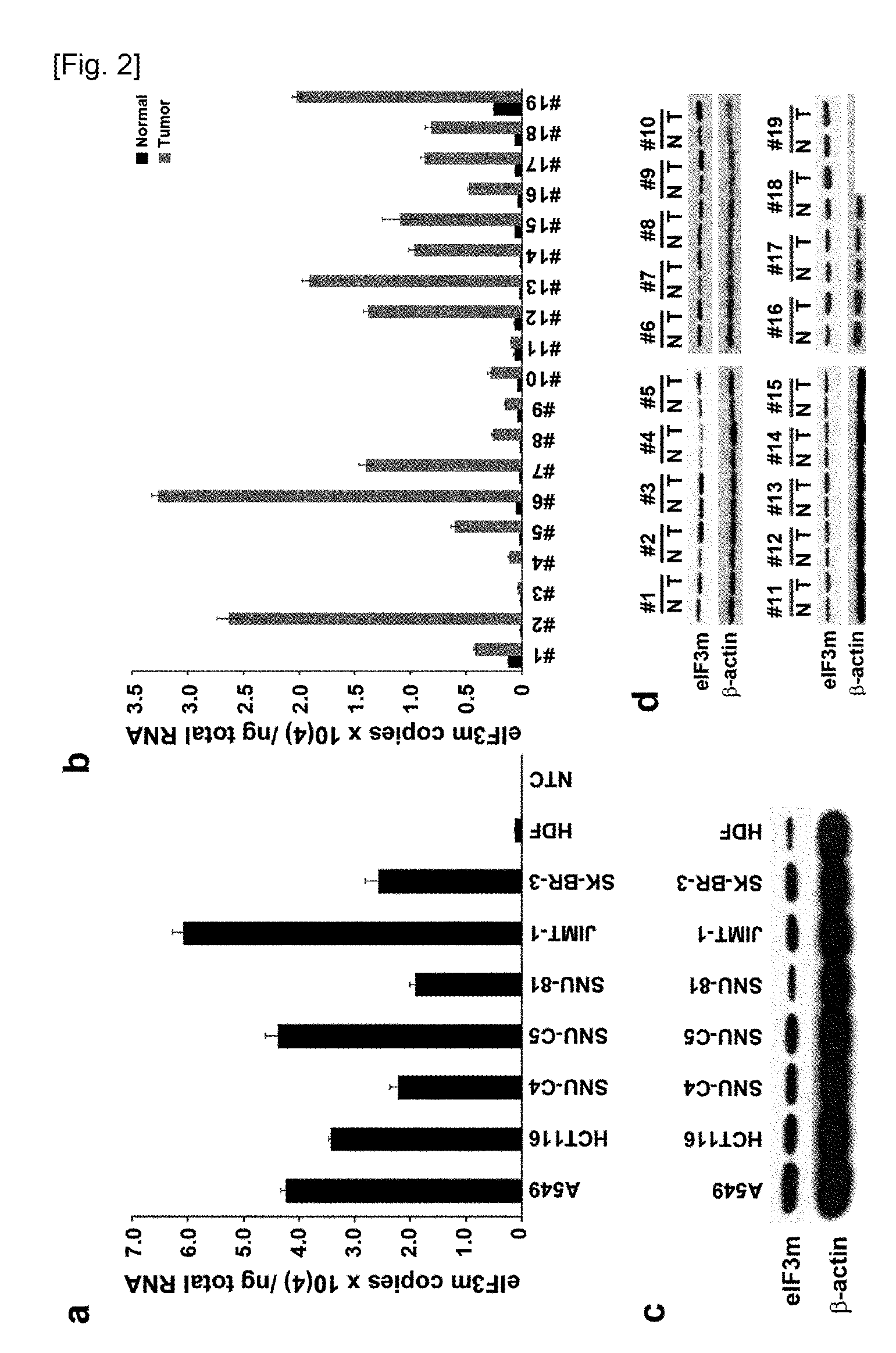 Use of eif3m for the diagnosis and treatment of cancer