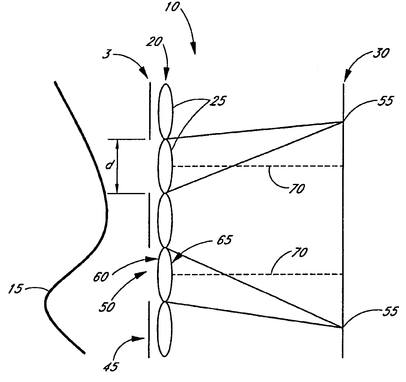 Large dynamic range Shack-Hartmann wavefront sensor