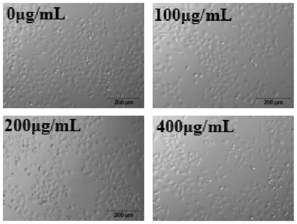 A kind of preparation method and application of Pyracantha polysaccharide iron complex