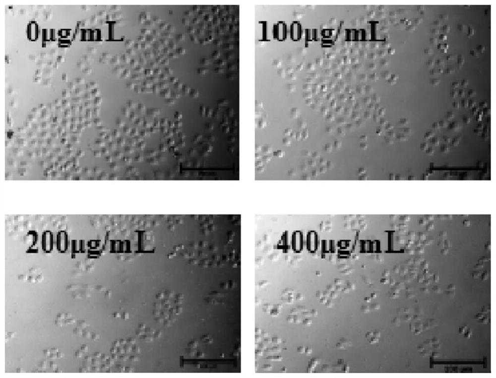 A kind of preparation method and application of Pyracantha polysaccharide iron complex