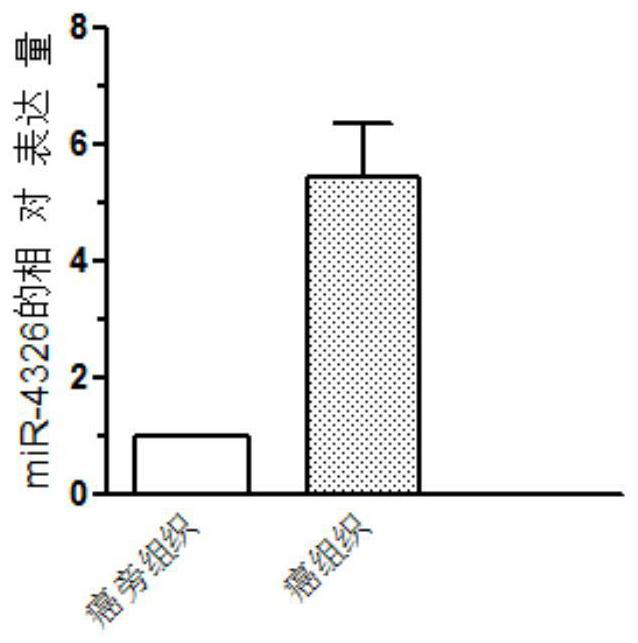 Markers of miRNAs for diagnosis and treatment of liver cancer