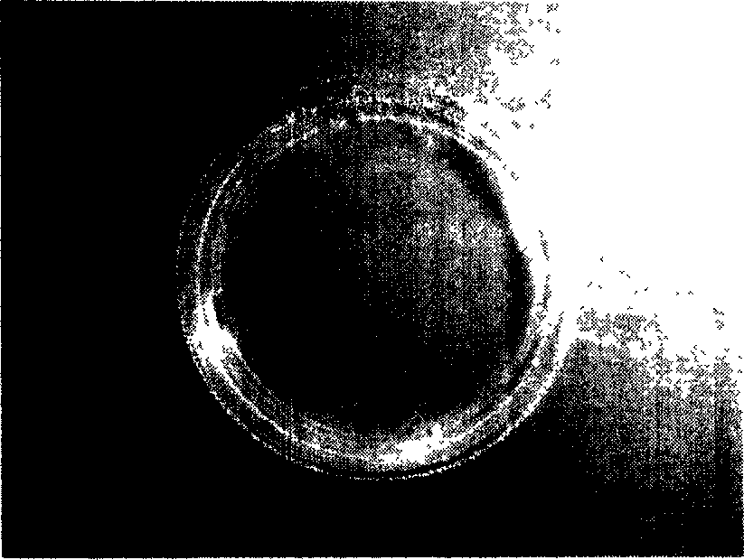 Medical cornea paster and its preparation method