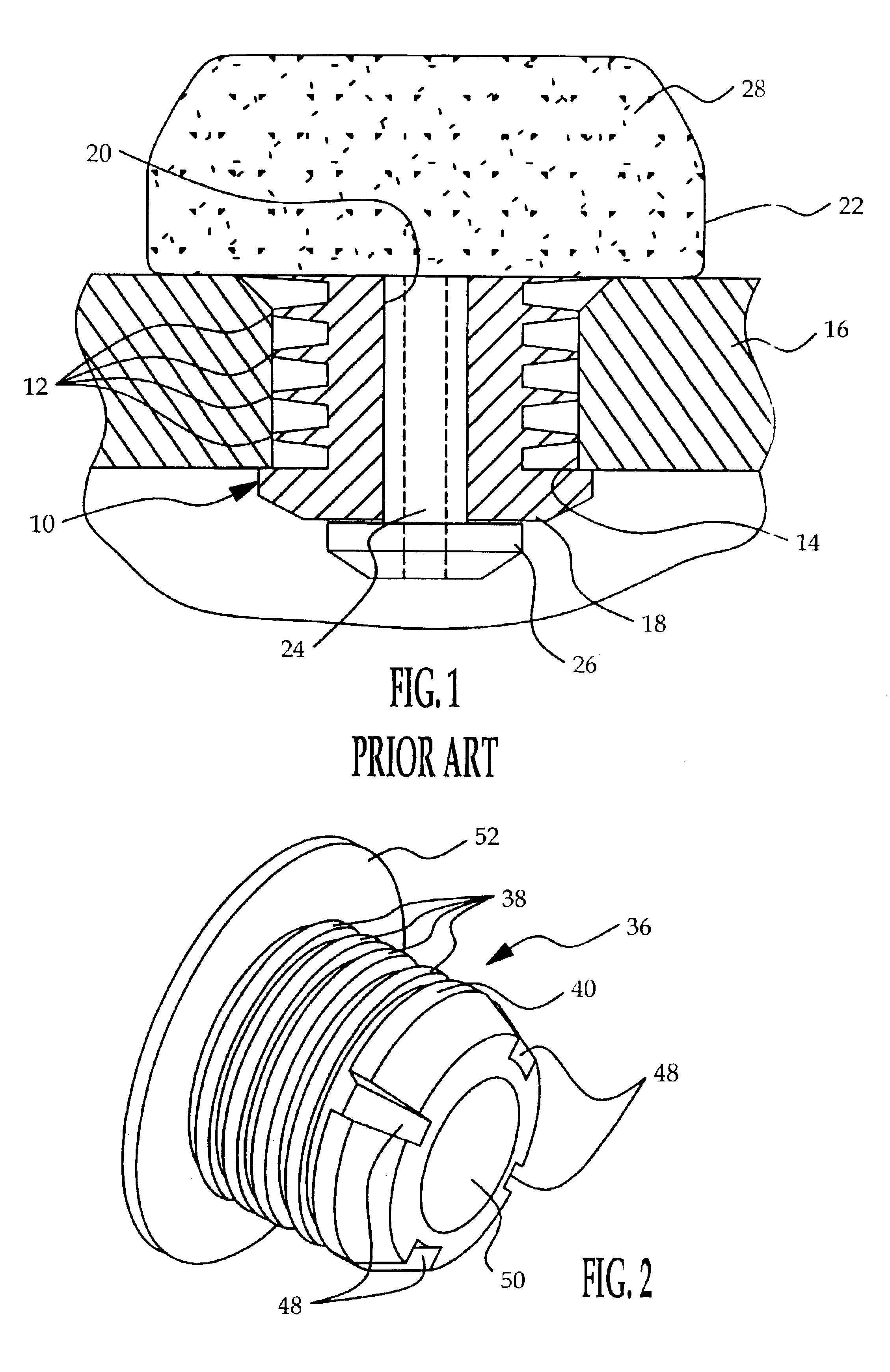 Self-retaining pressure sensor assembly having notched seal retention flange