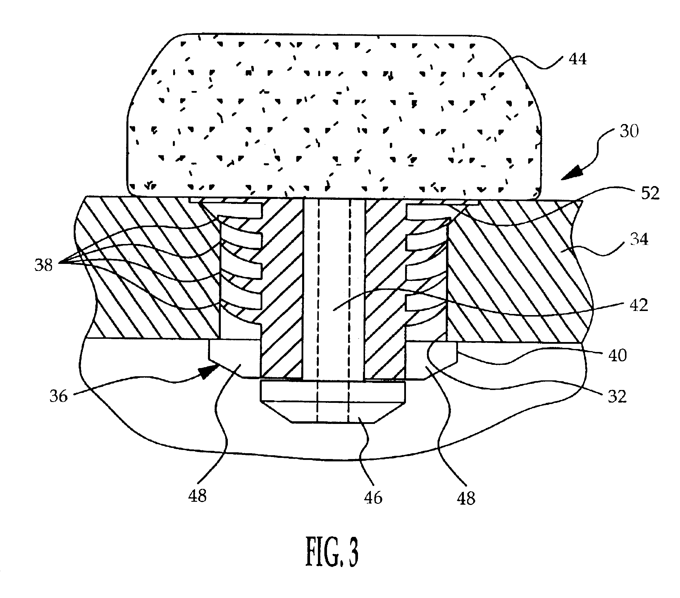 Self-retaining pressure sensor assembly having notched seal retention flange