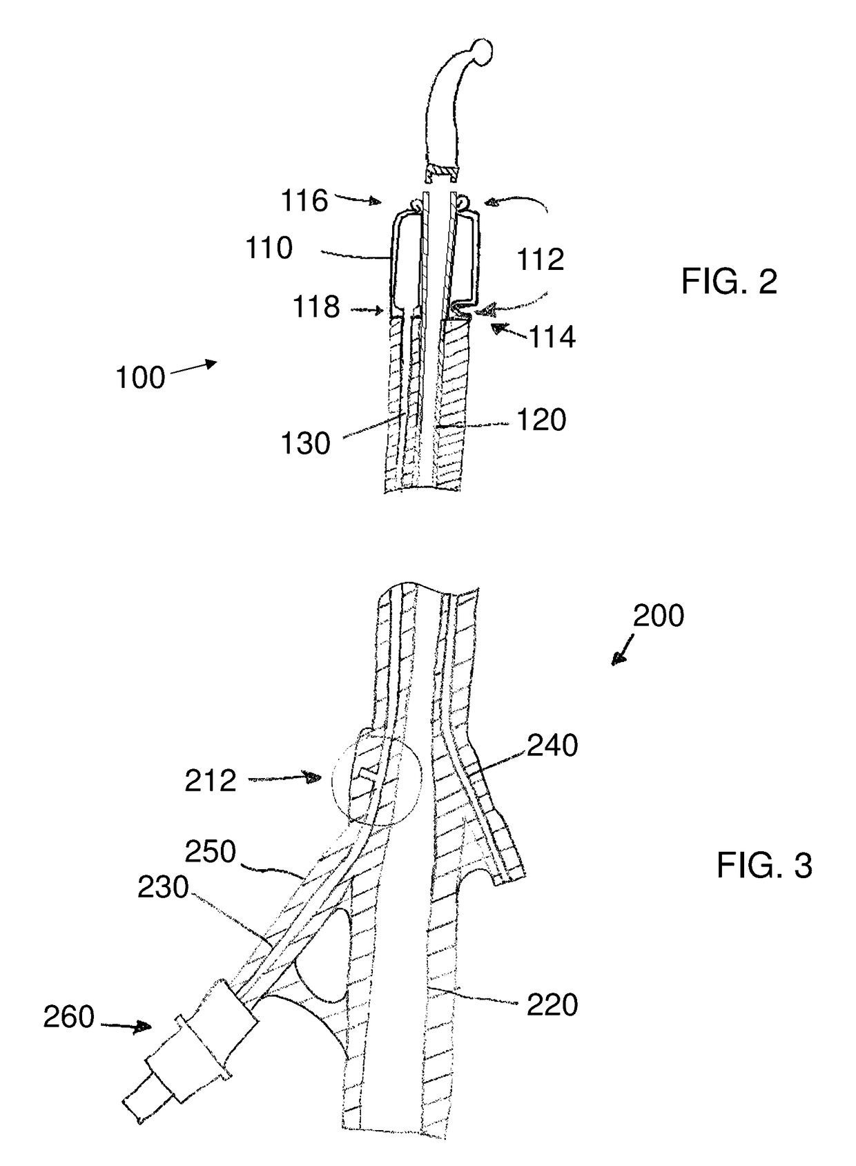 Stretch valve balloon catheter and methods for producing and using same