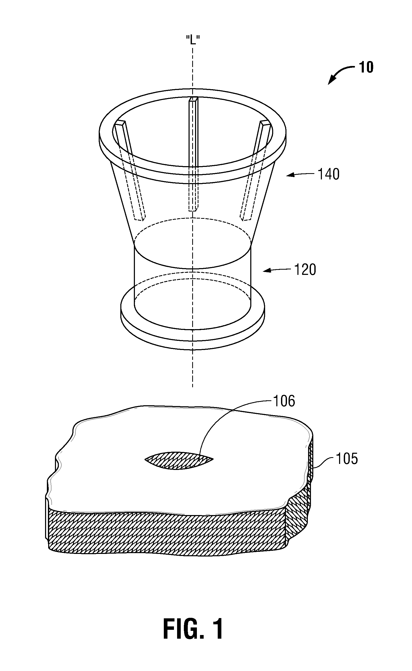 Adjustable height port including retention elements