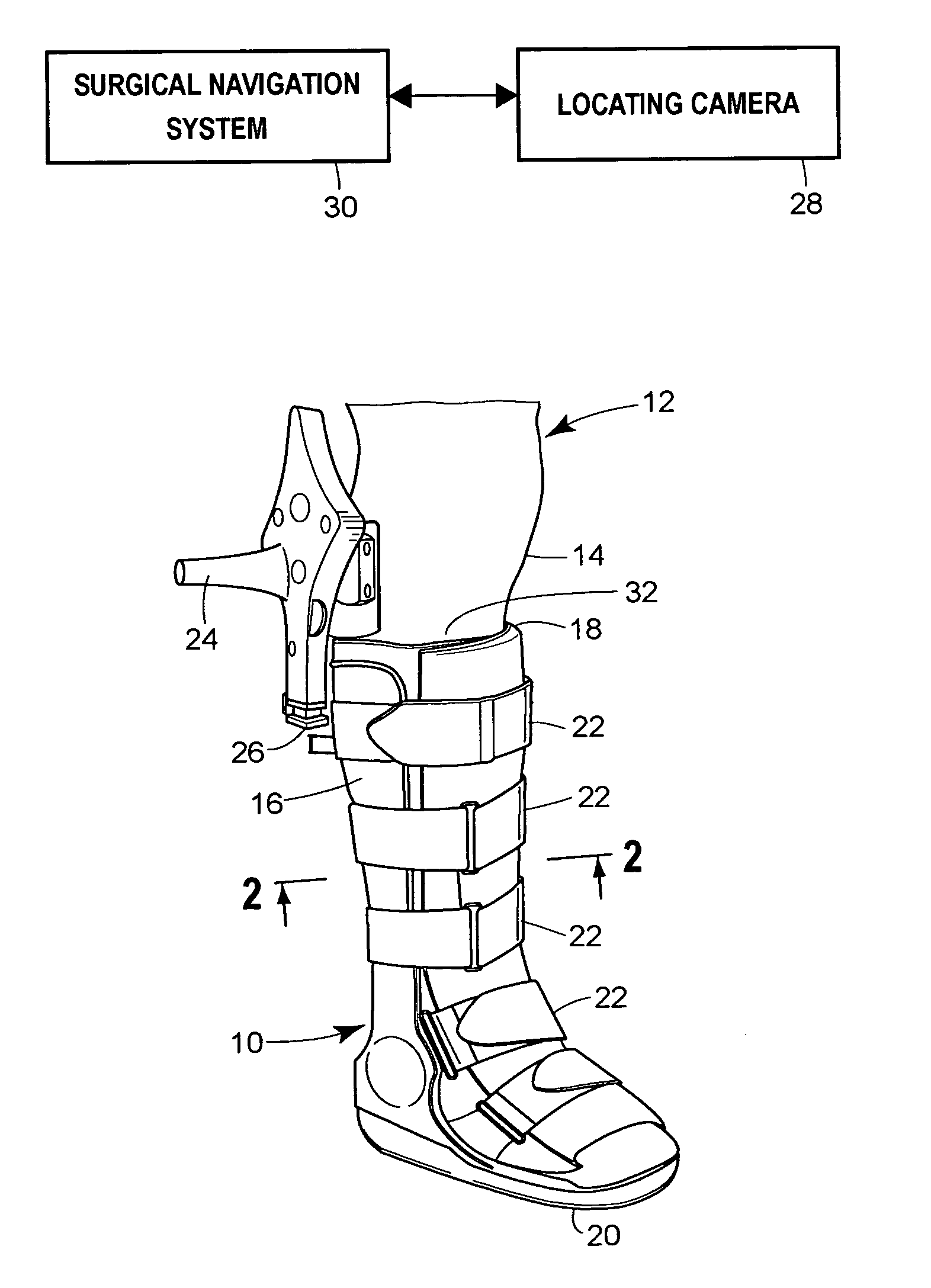 Non-invasive tracking device and method