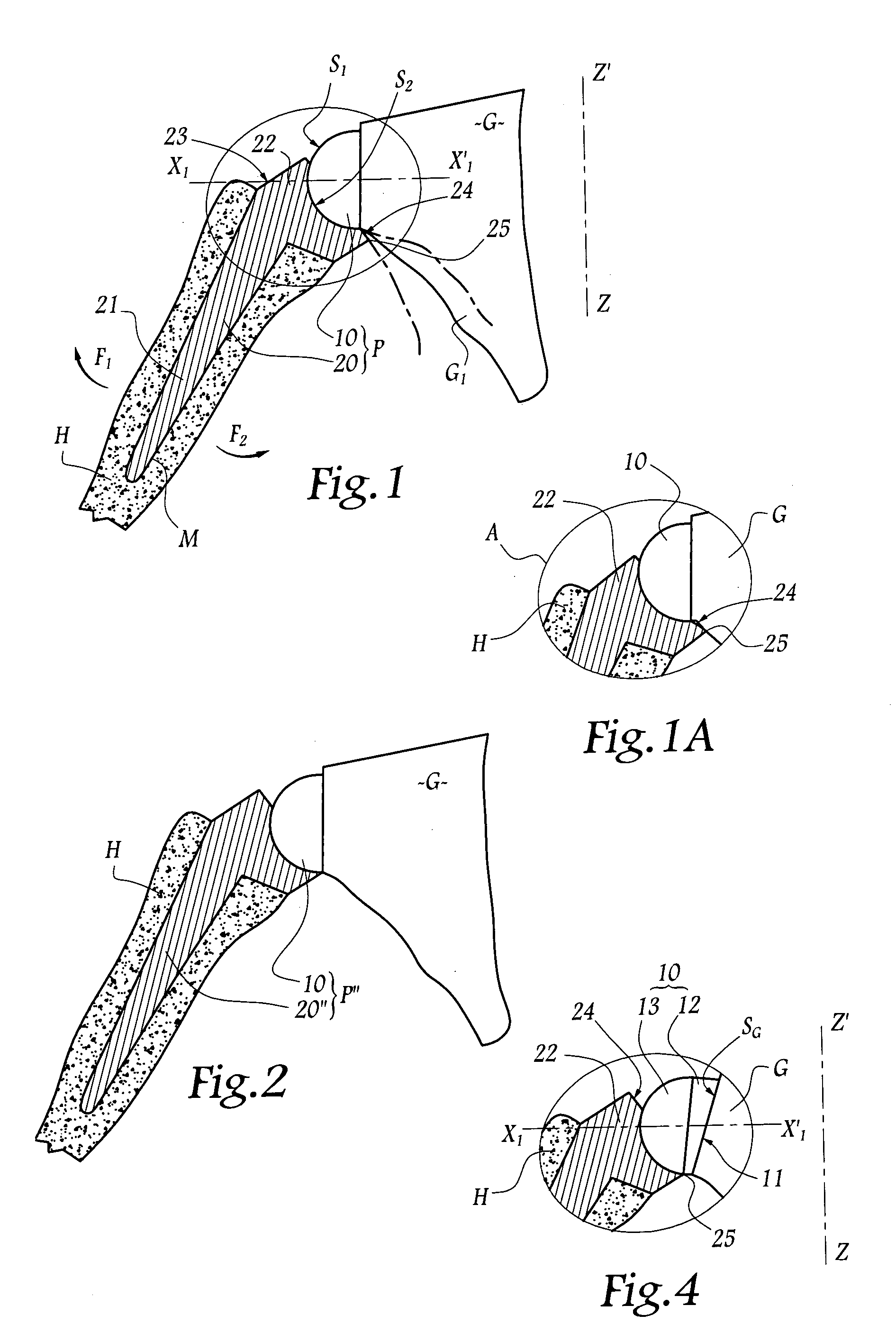 Set of humeral components for total shoulder prosthesis