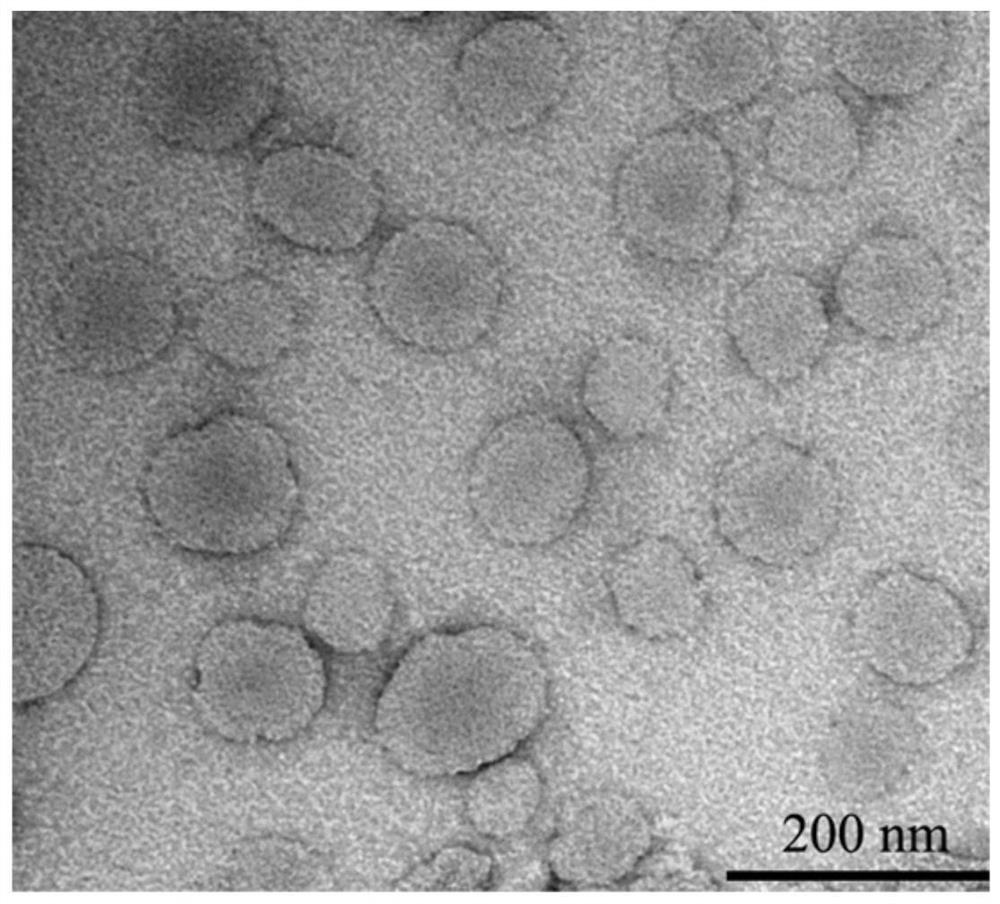 A composite nano-diagnosis and treatment preparation and its preparation method