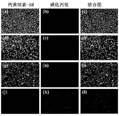 Metal β-lactamase inhibitor open chain pyridine carboxylic acid derivative and preparation method thereof