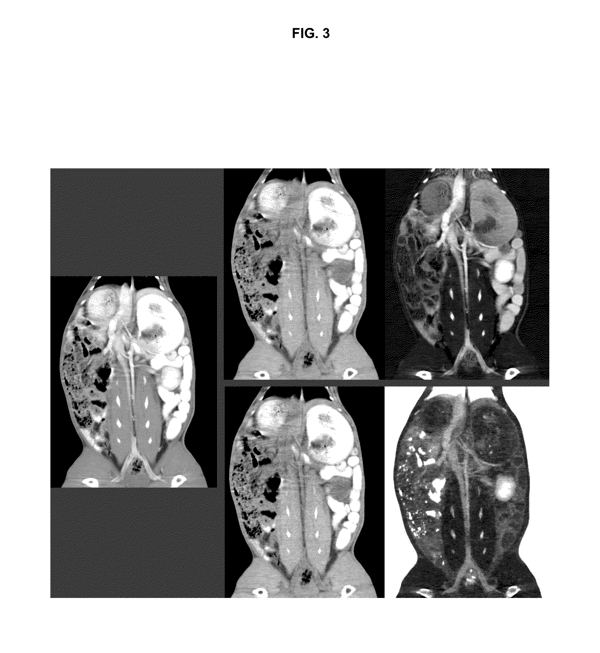 Enteric ct contrast material based on low-z atoms