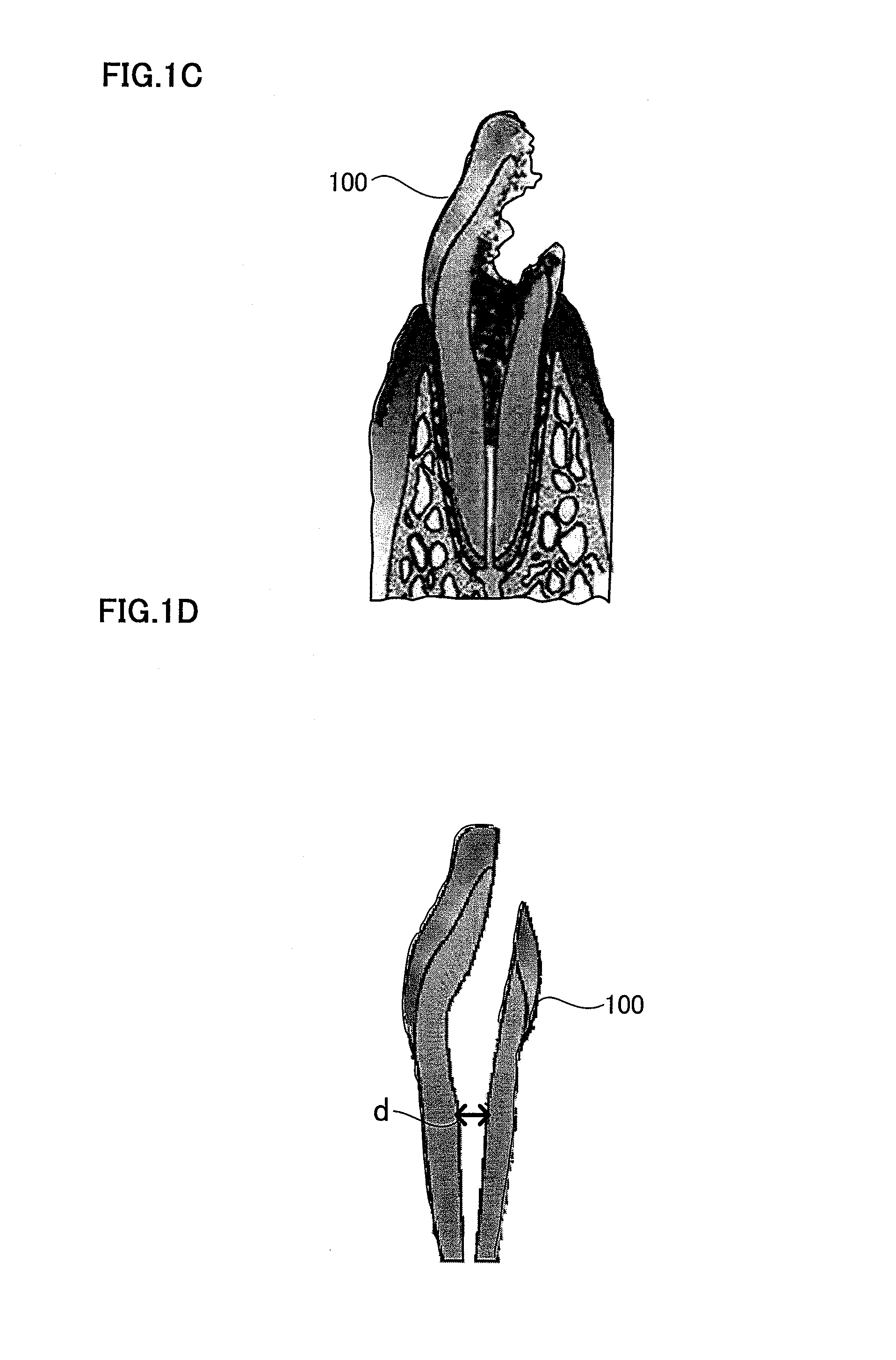 Root canal filler and dental tissue regeneration method