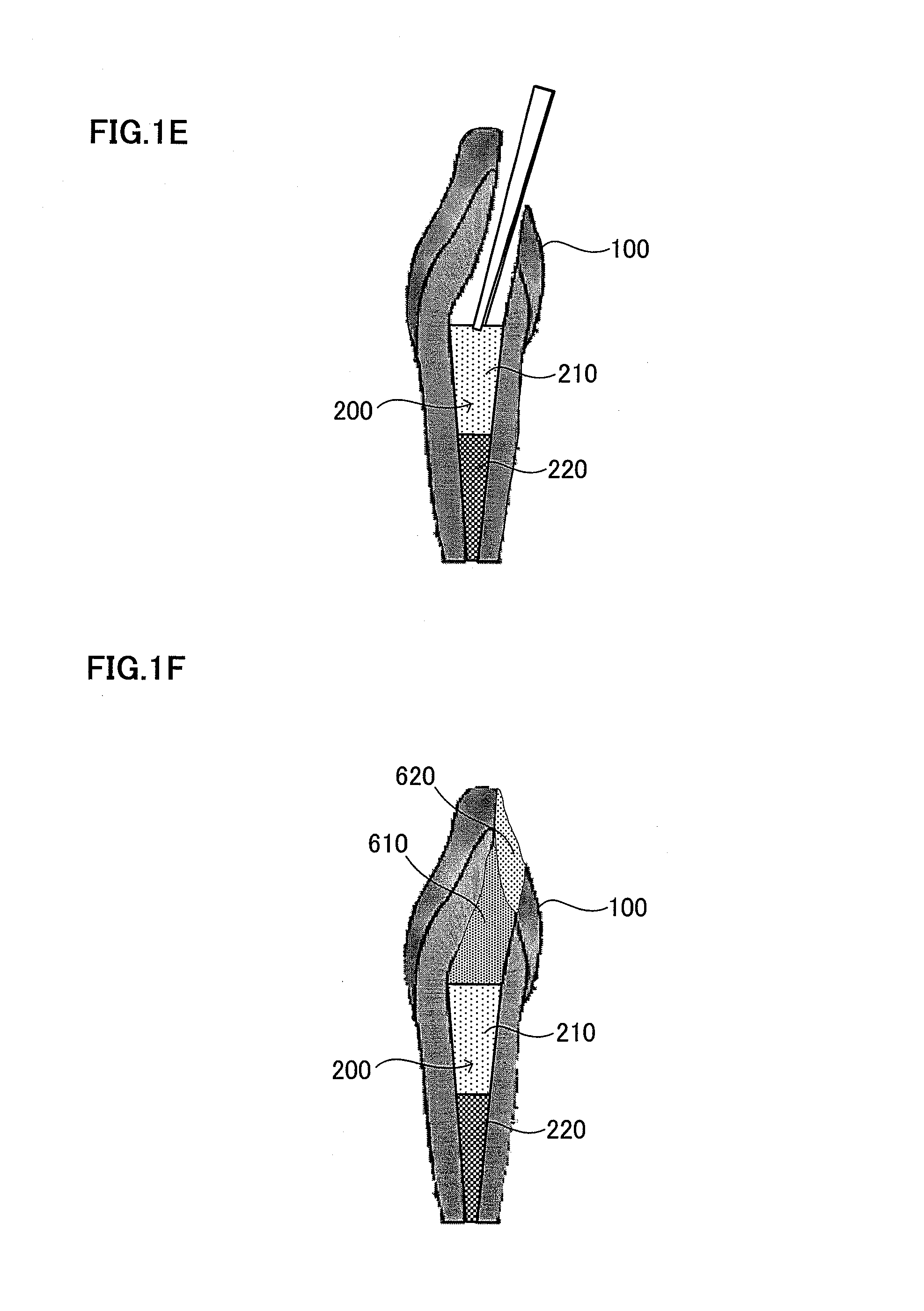 Root canal filler and dental tissue regeneration method