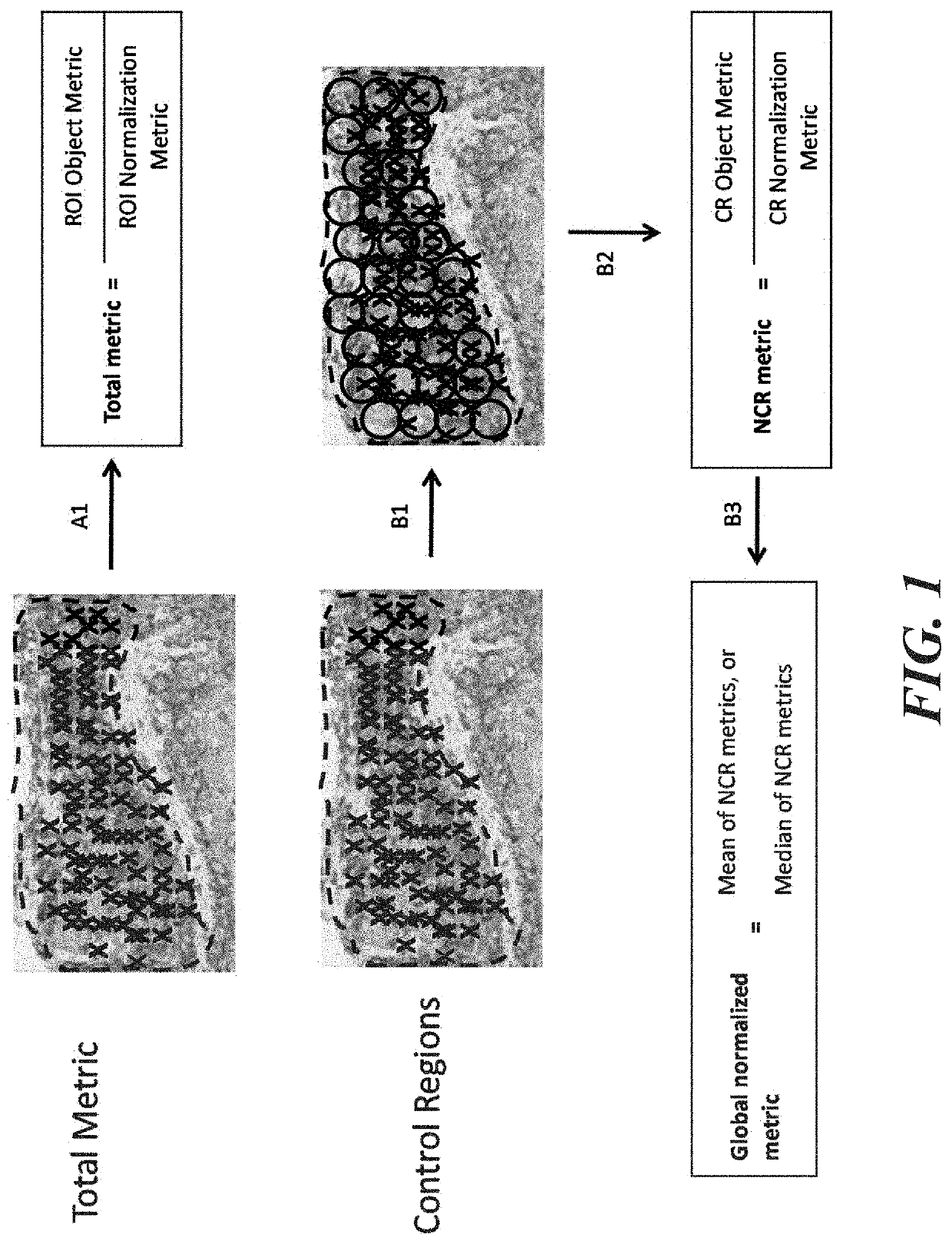 Methods and systems for evaluation of immune cell infiltrate in stage iii colorectal cancer