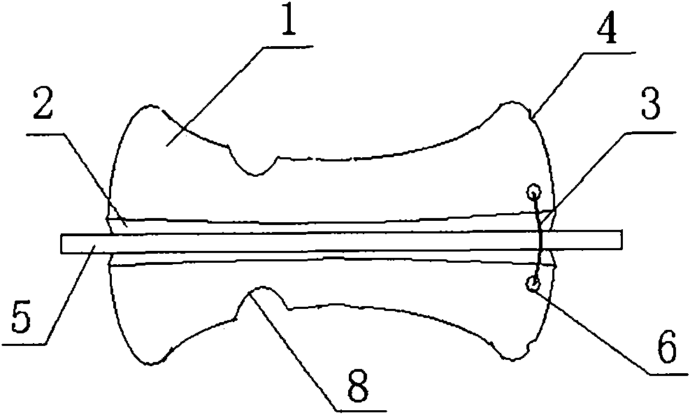 Tracheal cannula fixing device