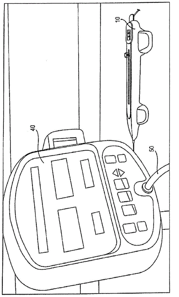 Controller for an atherectomy device