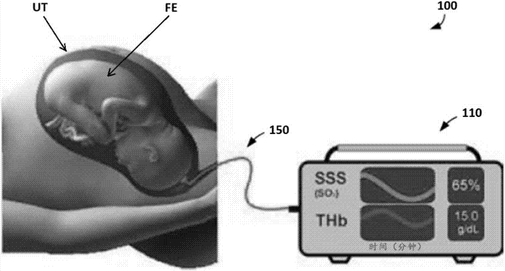 Systems and methods for measuring fetal cerebral oxygenation