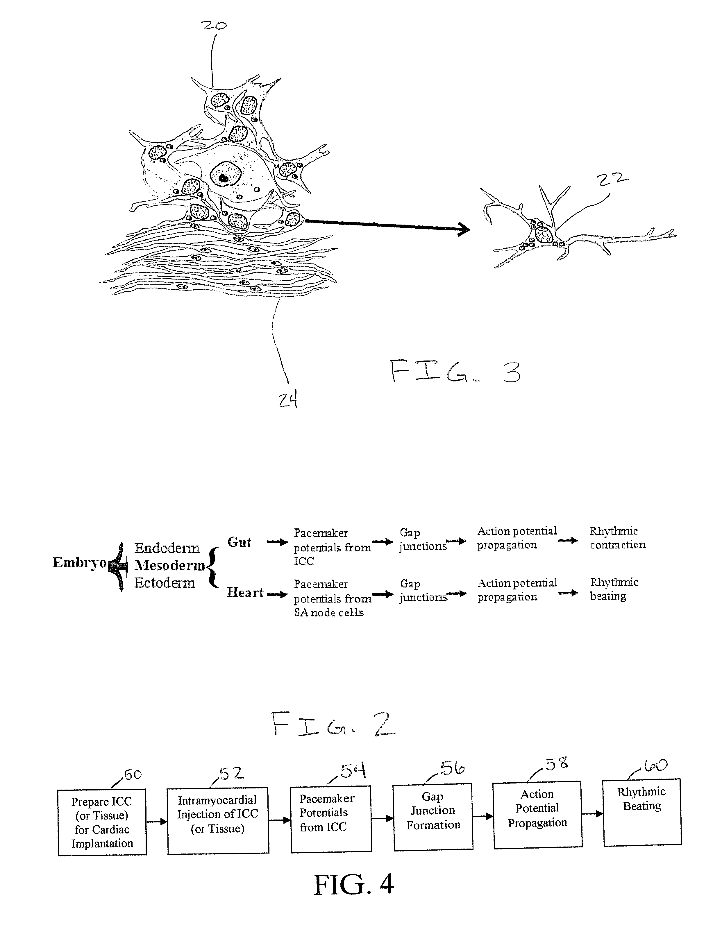 Biological pacemaker compositions and systems incorporating interstitial cells of cajal