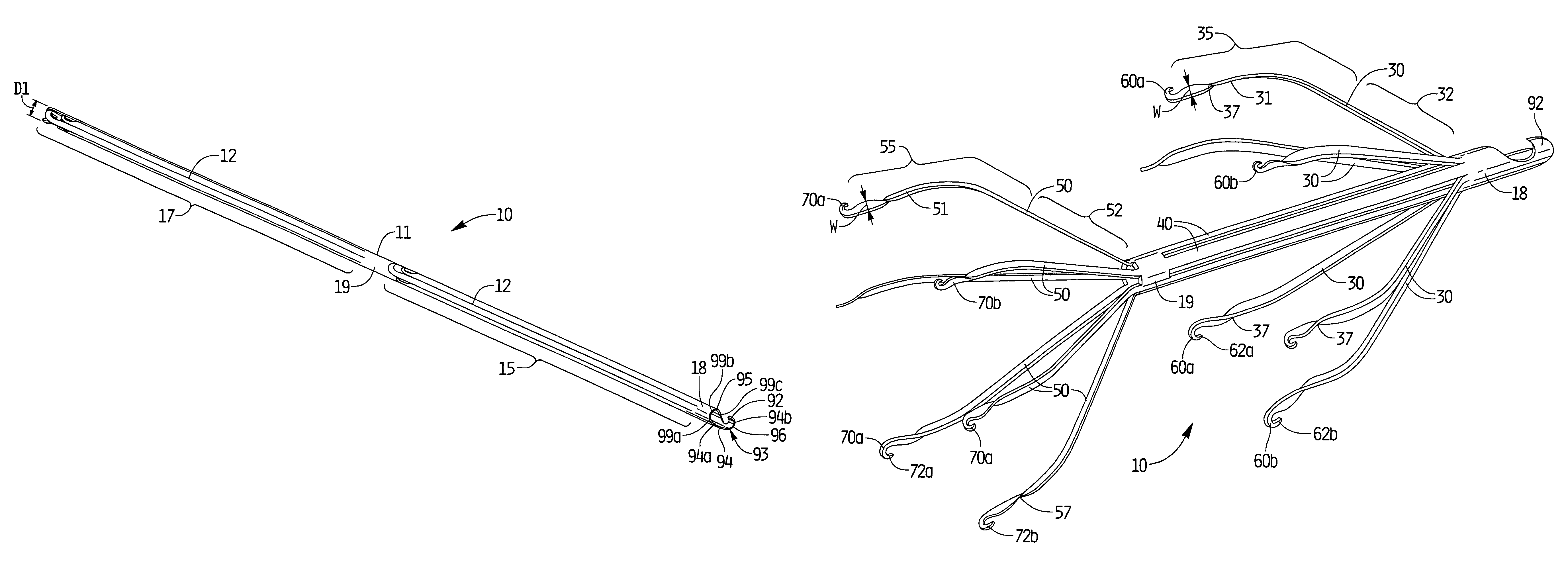 Vein filter