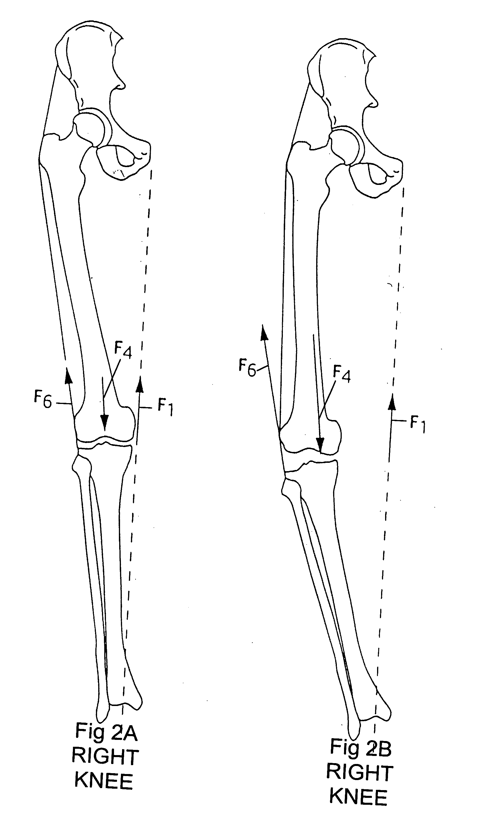 Magnetic vector control system