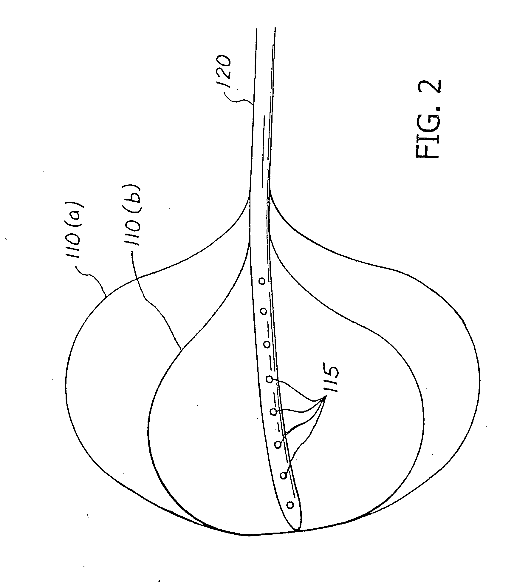 Balloon system and methods for treating obesity