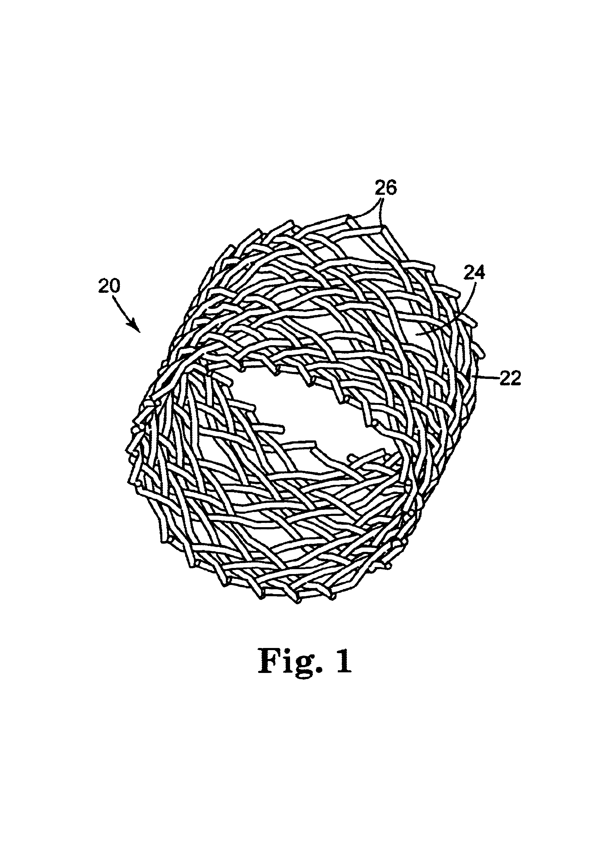 Stent delivery device and method