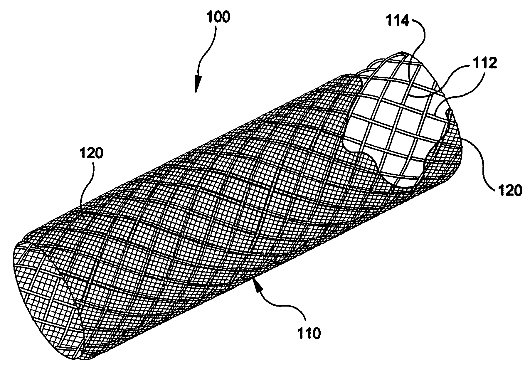 Stent-graft with bioabsorbable structural support