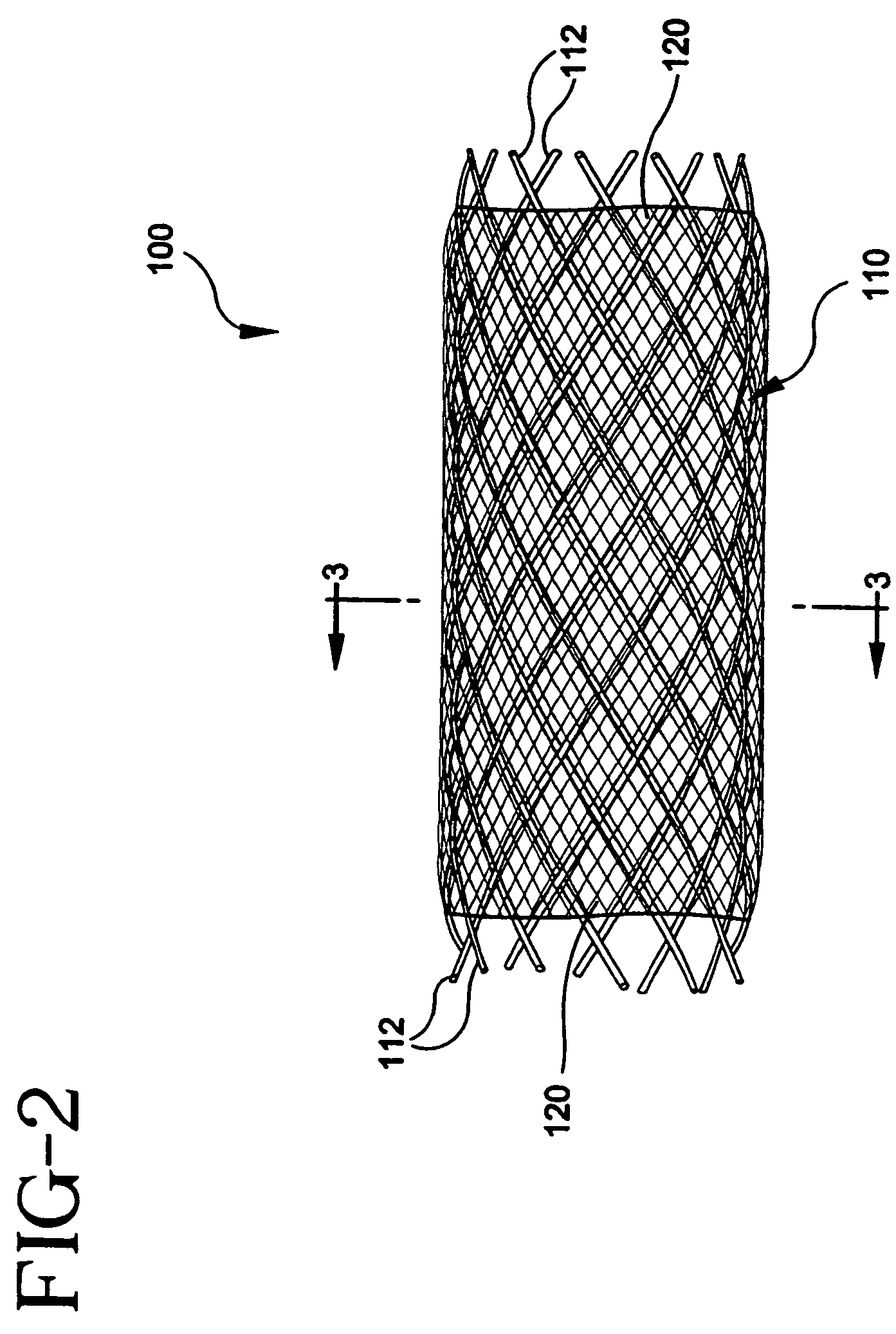 Stent-graft with bioabsorbable structural support