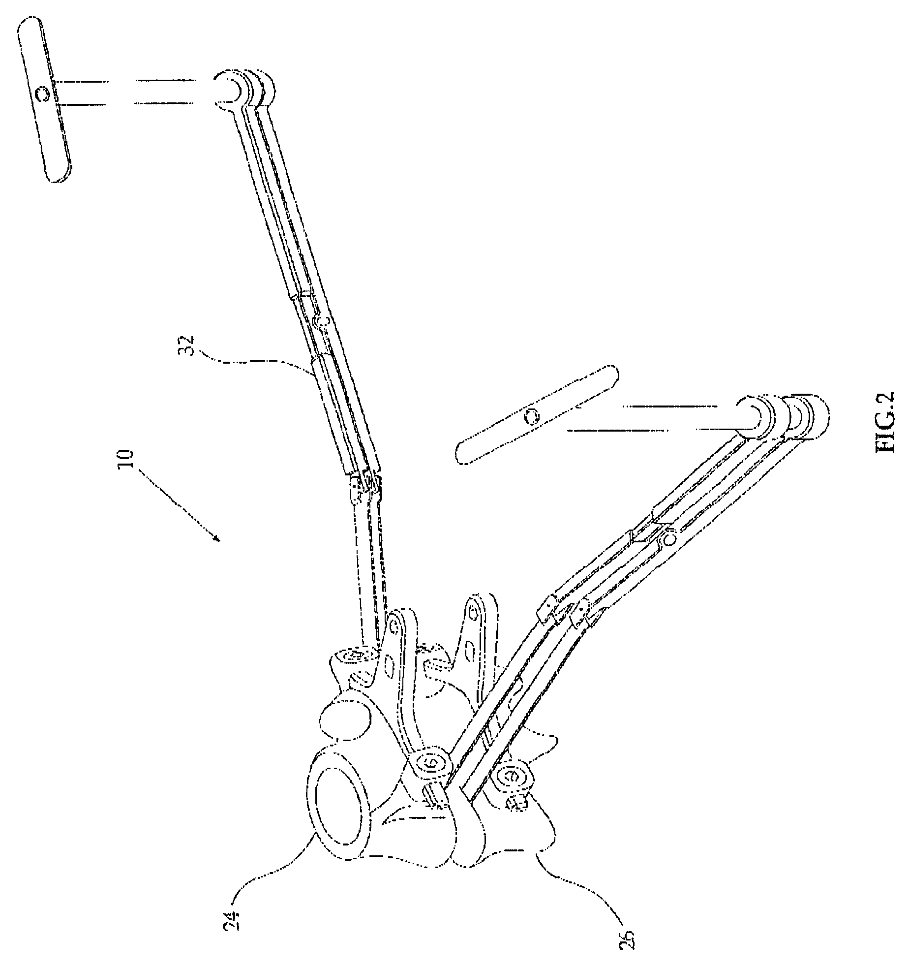 Inserting anterior and posterior spinal prostheses