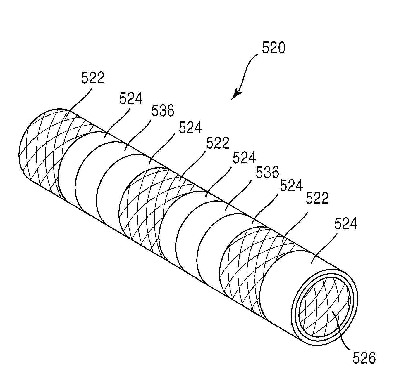 Bioabsorbable stent