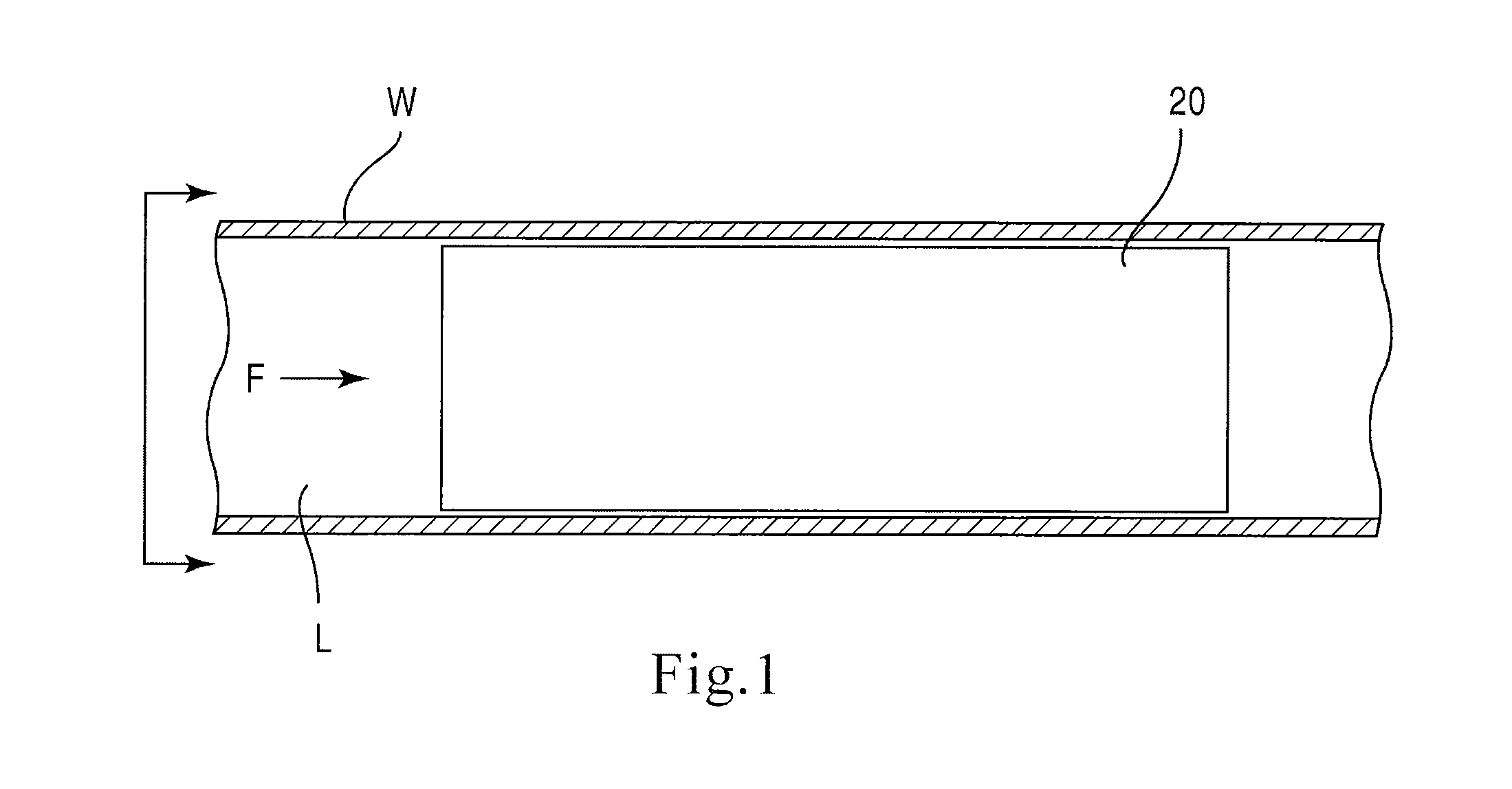 Bioabsorbable stent