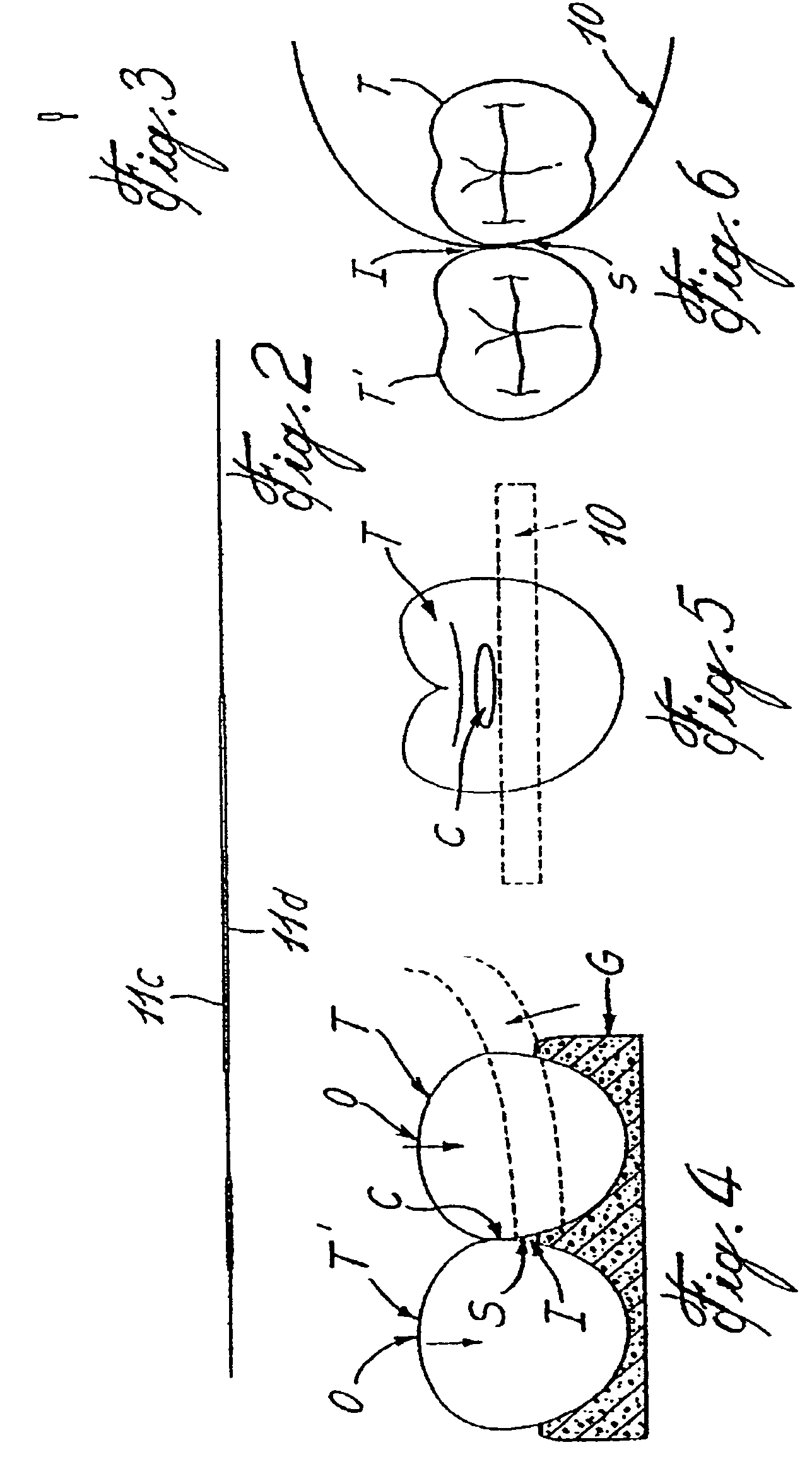 Interproximal tooth coating applicator