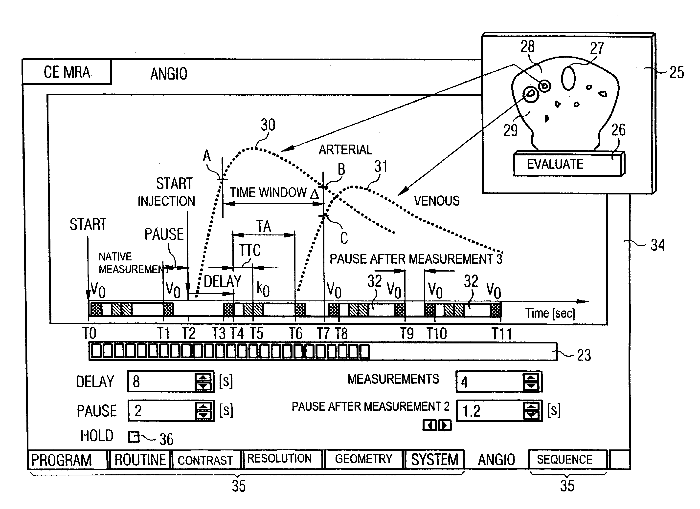 Method and magnetic resonance tomography apparatus for graphic planning of angiographic exposures using a contrast agent